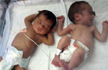 Babies no one wants to take home